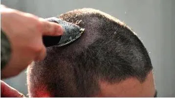 hair