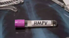 hmpv-virus-gujarat-case