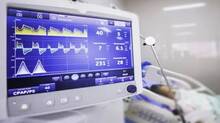 ventilator