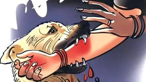 dog-bite-attack