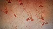 typhoid-