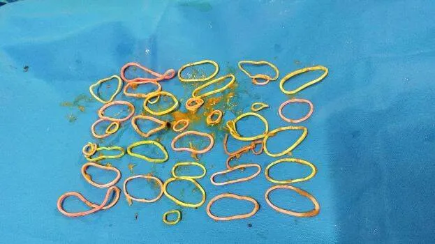 rubber-bands
