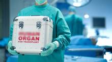 transplantation