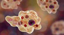 amoeba