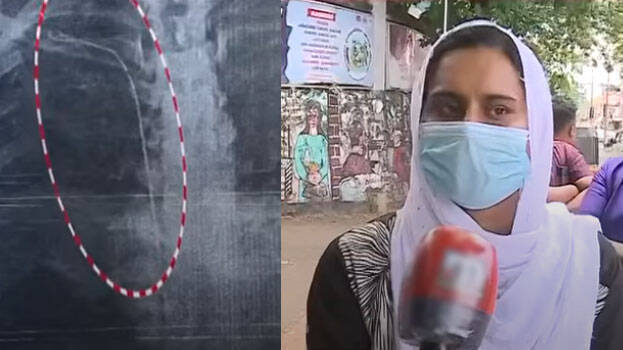 surgical-tube surgical-tube