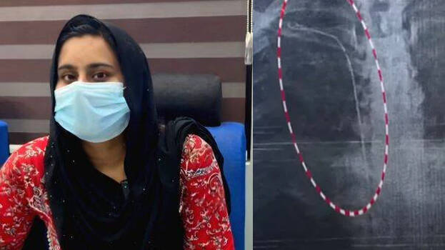 guide-wire-stuck- guide-wire-stuck-