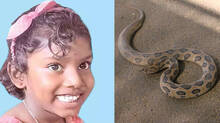 snakebite