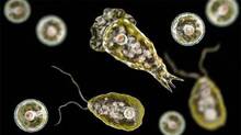 amoebic-encephalitis-