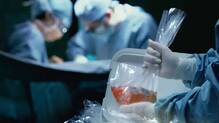organ-trafficking